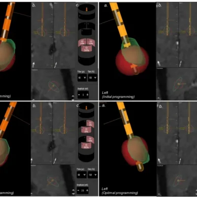 O que é a programação guiada por imagem?